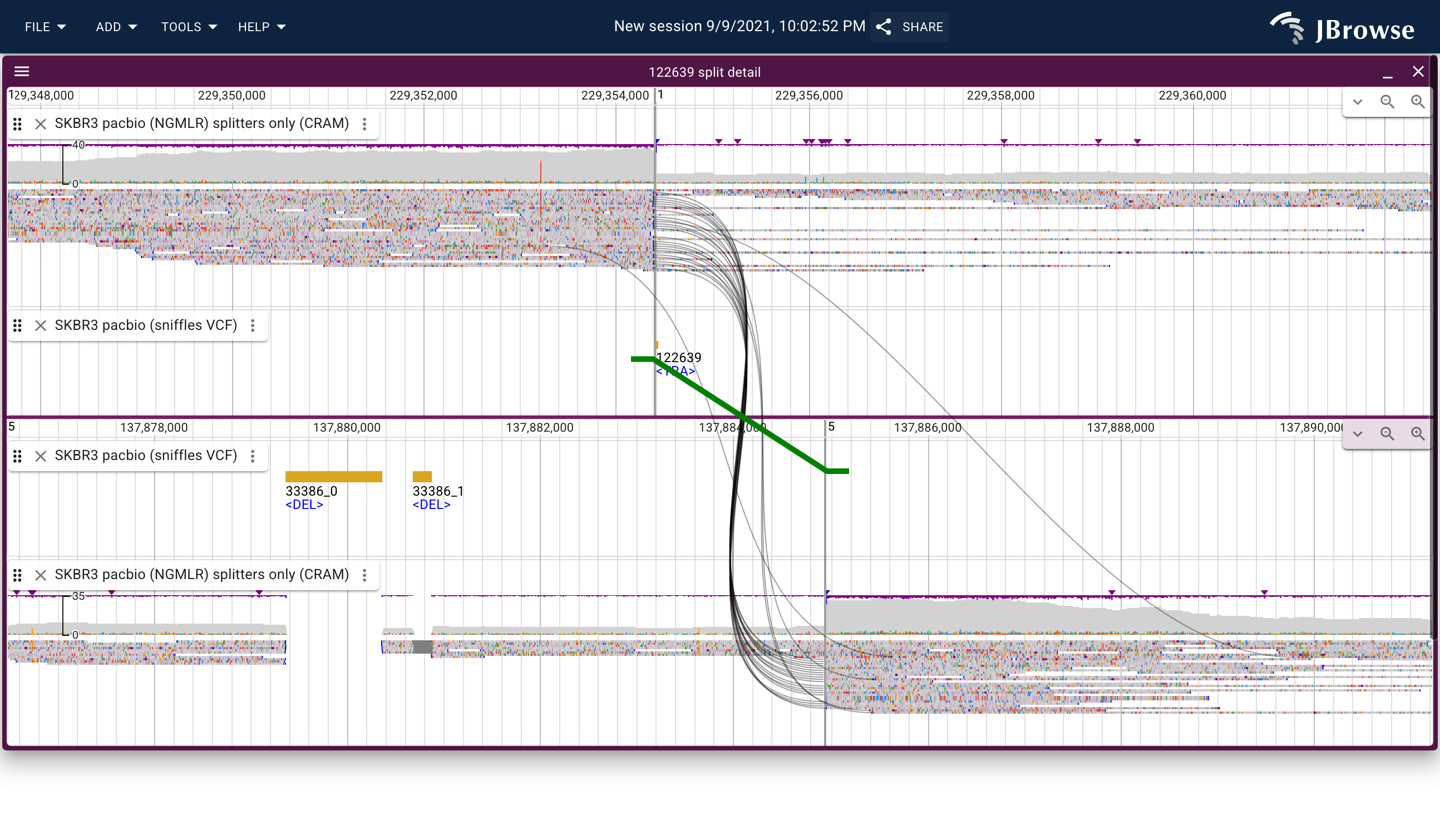 SKBR3 PacBio translocation in the breakpoint split view. The top panel shows one breakpoint locus (~chr1:229 Mb) and the bottom shows the other (~chr1:137 Mb). Black splines connect supporting reads across the two panels; the green diagonal line with arrowheads is the SV call. The density of splines is proportional to the number of spanning reads.